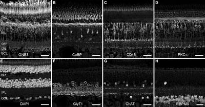 No evidence for age-related alterations in the marmoset retina